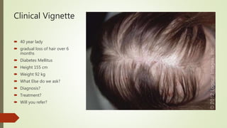 Clinical Vignette
 40 year lady
 gradual loss of hair over 6
months
 Diabetes Mellitus
 Height 155 cm
 Weight 92 kg
 What Else do we ask?
 Diagnosis?
 Treatment?
 Will you refer?
 