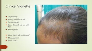 Clinical Vignette
 25 year lady
 Losing handsful of hair
 Sudden onset
 Has a 2 month old son with
her
 Feeling Tired
 What else is relevant to ask?
 Management?
 What Tests?
 