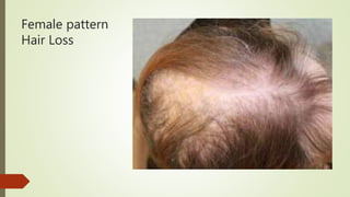 Female pattern
Hair Loss
 