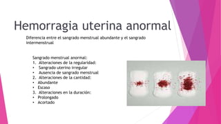 Amenorrea y Hemorragias uterinas disfuncional 