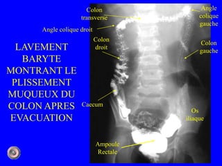 1 anatomie et semiologie rdiologique5 (version5) | PPTX