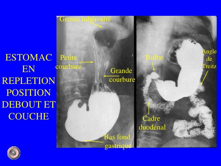 1 anatomie et semiologie rdiologique5 (version5)