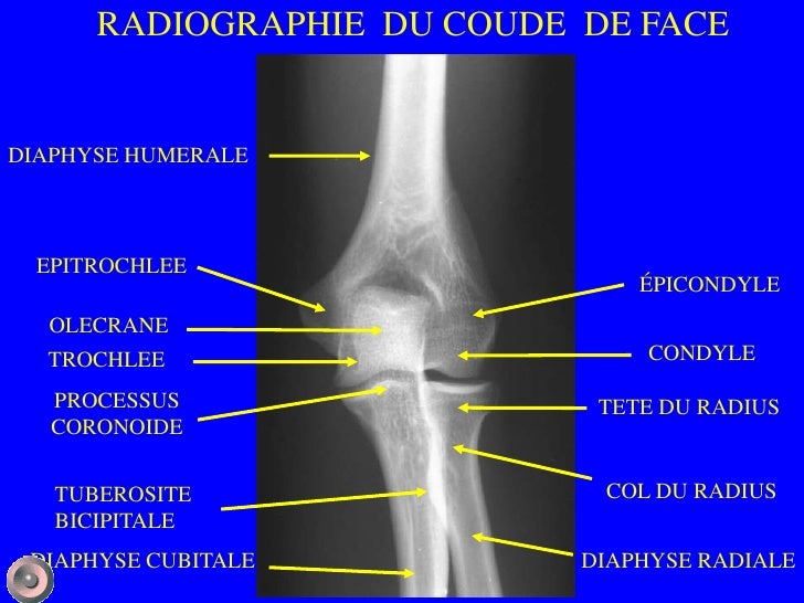 1 Anatomie Et Semiologie Rdiologique Version 1