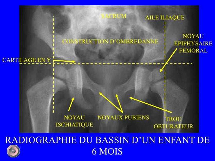 1 Anatomie Et Semiologie Rdiologique Version 1