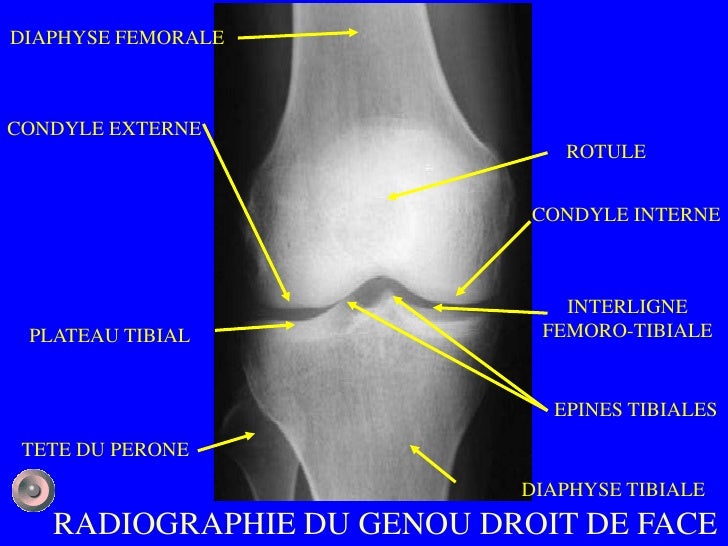 1 anatomie et semiologie rdiologique (version 1) 1 anatomie et semiologie rdiologique (version 1)