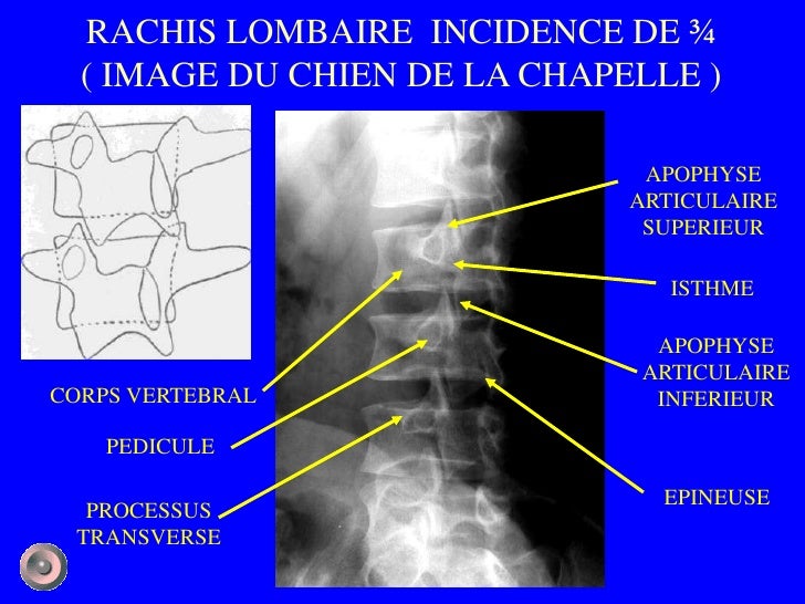 1 Anatomie Et Semiologie Rdiologique Version 1