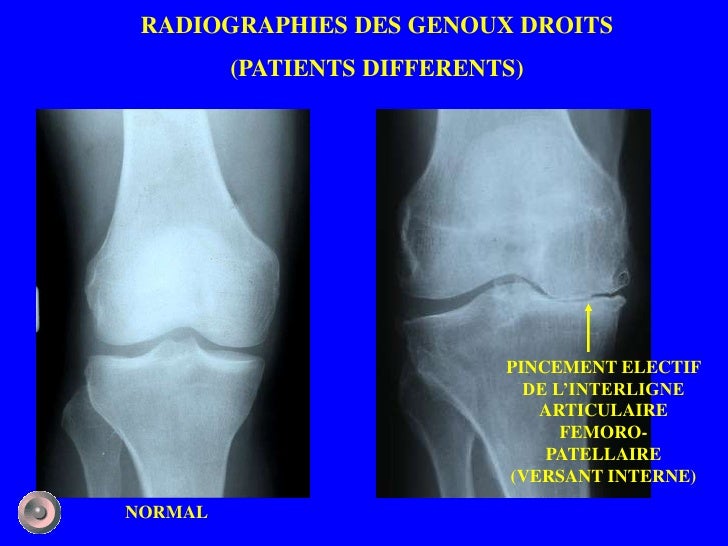 1 anatomie et semiologie rdiologique (version 2) 1 anatomie et semiologie rdiologique (version 2)
