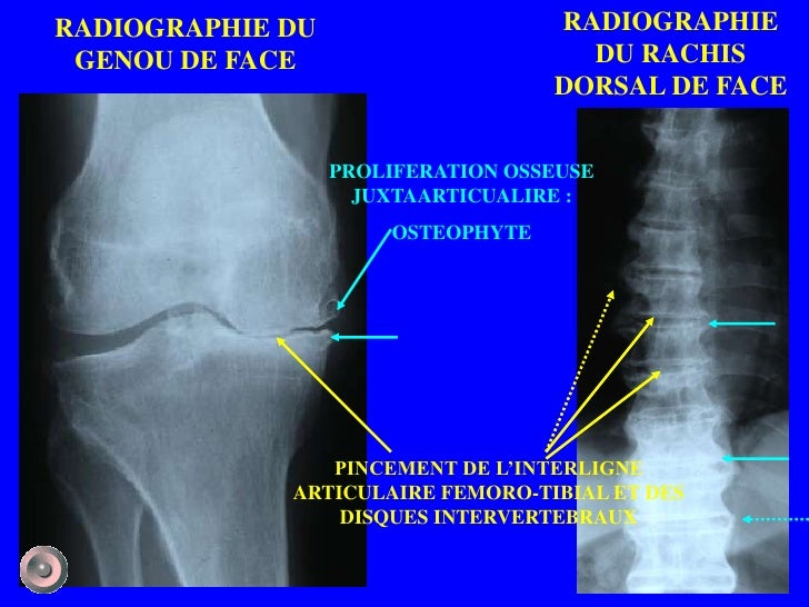 1 anatomie et semiologie rdiologique (version 2) 1 anatomie et semiologie rdiologique (version 2)