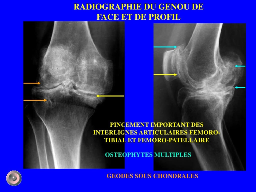 1 anatomie et semiologie rdiologique (version 2) 1 anatomie et semiologie rdiologique (version 2)