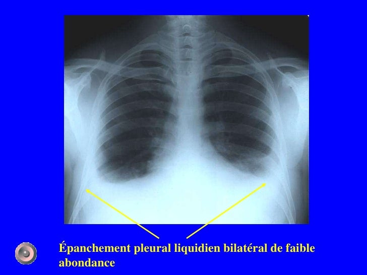 1 anatomie et semiologie rdiologique (version 3)