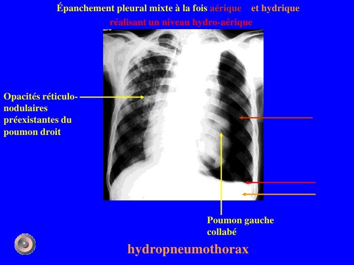 1 anatomie et semiologie rdiologique (version 3)
