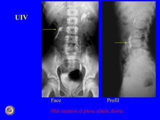 Anatomie ostéologie | PDF
