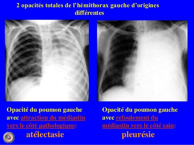 Anatomie ostéologie