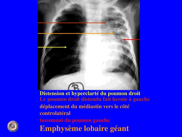 1 anatomie et semiologie rdiologique (version 4)