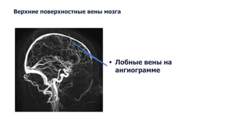 Anatomy of the venous system of the brain
