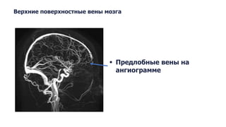 Anatomy of the venous system of the brain
