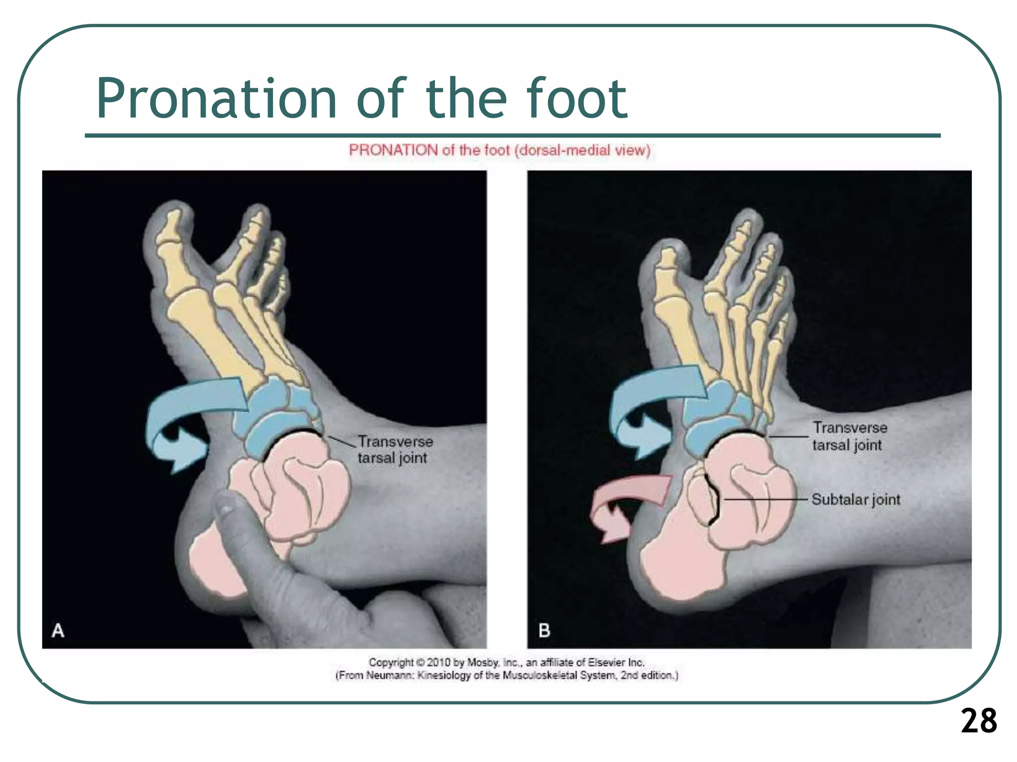 Pronation of the foot
28
 