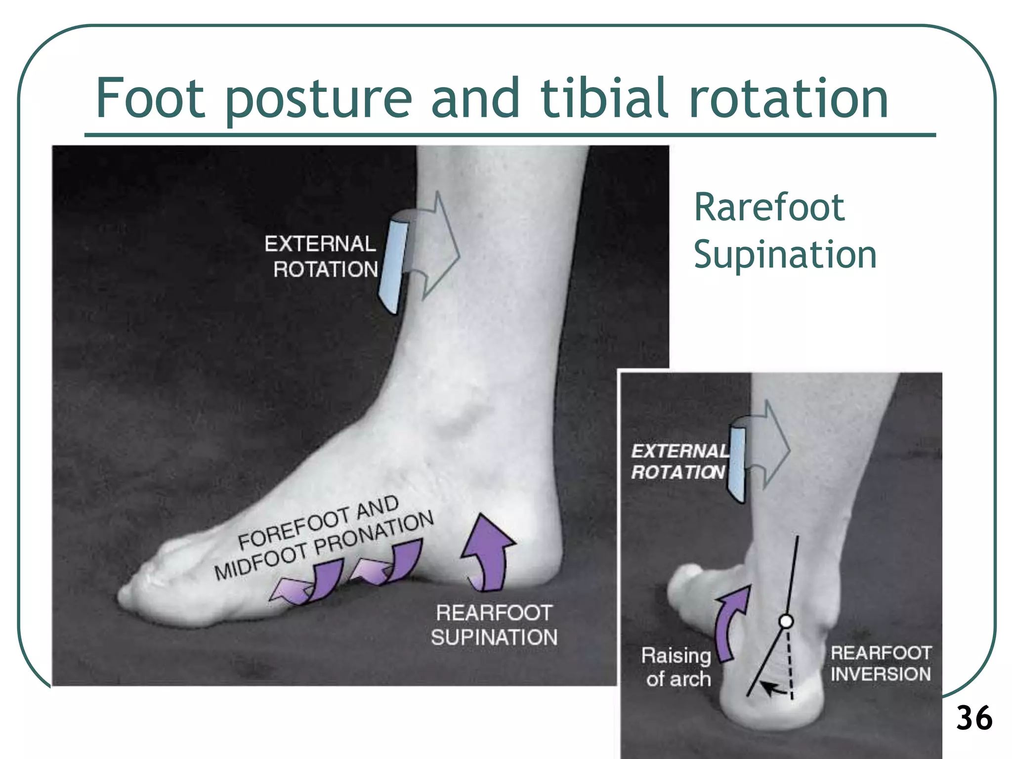 Foot posture and tibial rotation
36
Rarefoot
Supination
 