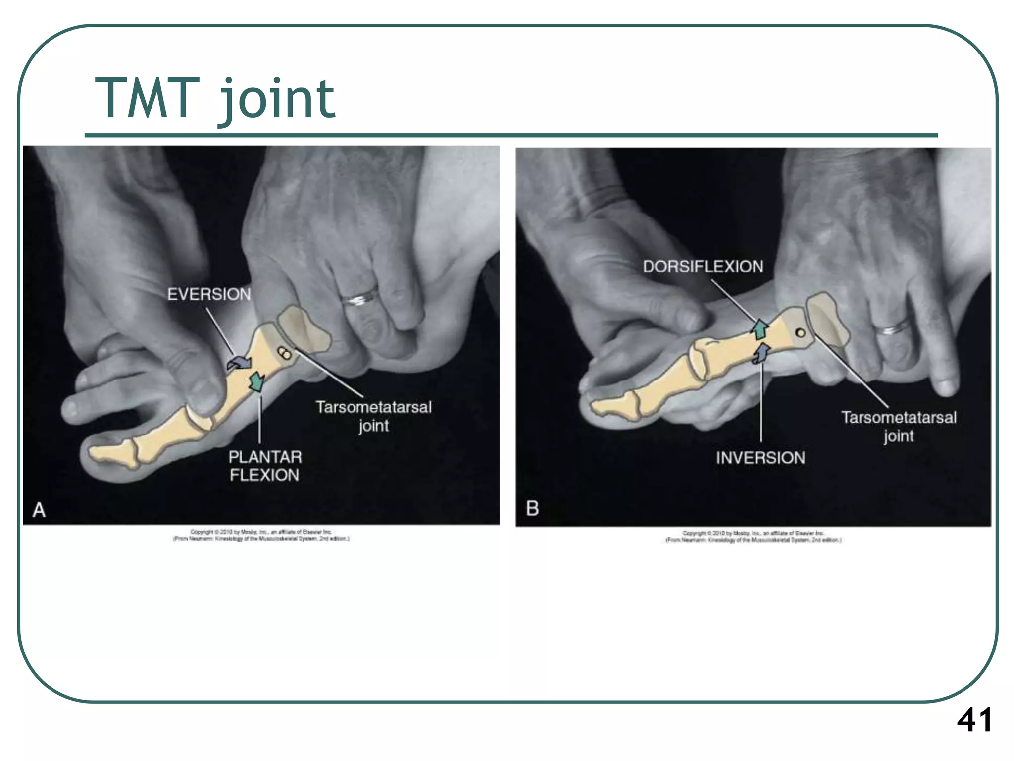 TMT joint
41
 