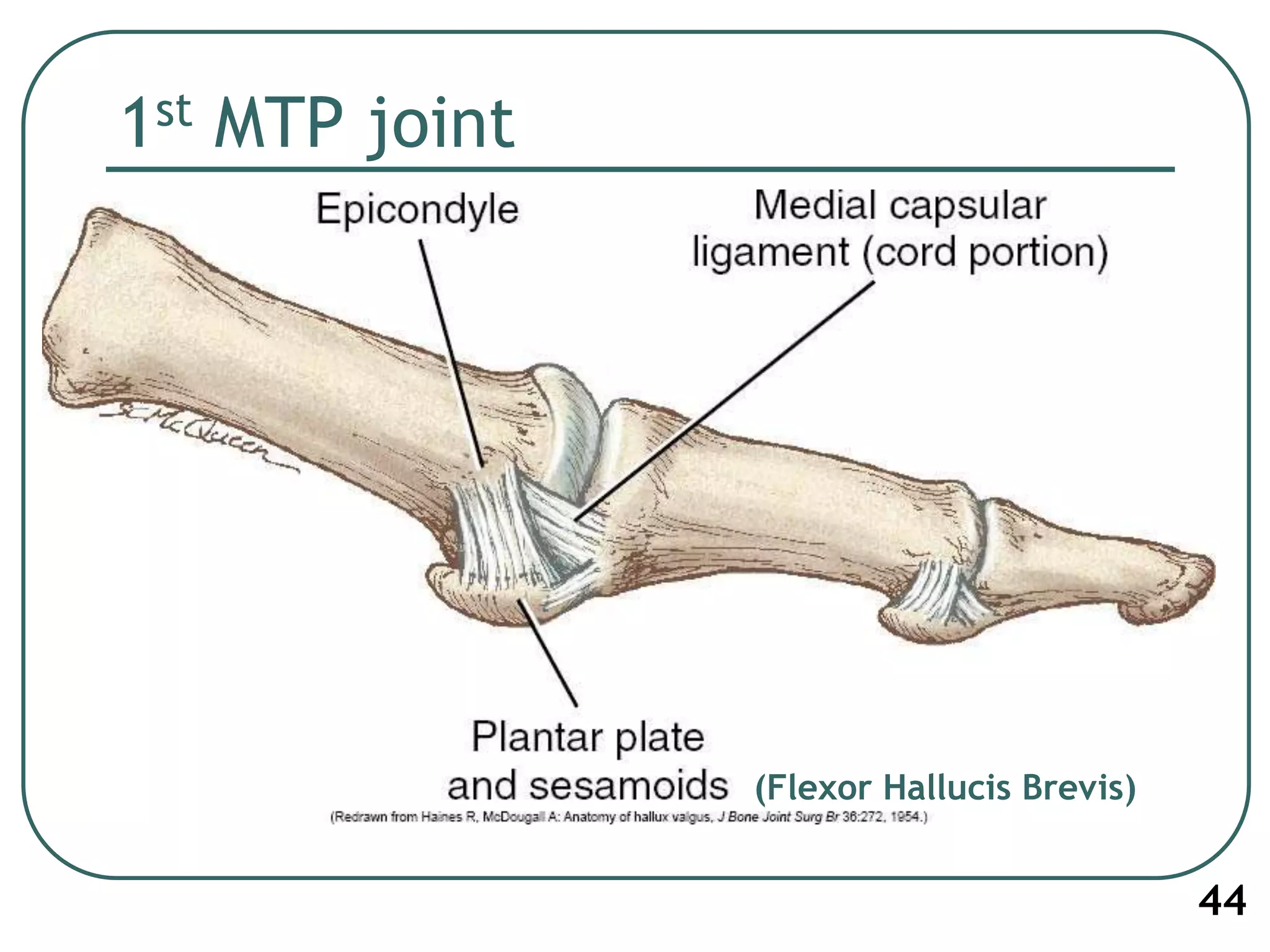 1st MTP joint
44
(Flexor Hallucis Brevis)
 