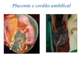 Placenta e cordão umbilical
 