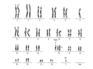 Arreglos del ADN Y Cromosomas (Genética Médica)