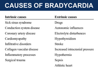 CAUSES OF BRADYCARDIA
 