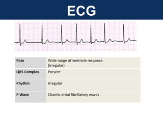 ECG
Rate Wide range of ventricle response
(irregular)
QRS Complex Present
Rhythm Irregular
P Wave Chaotic atrial fibrillatory waves
 