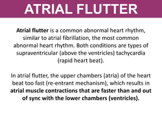 ATRIAL FLUTTER
Atrial flutter is a common abnormal heart rhythm,
similar to atrial fibrillation, the most common
abnormal heart rhythm. Both conditions are types of
supraventricular (above the ventricles) tachycardia
(rapid heart beat).
In atrial flutter, the upper chambers (atria) of the heart
beat too fast (re-entrant mechanism), which results in
atrial muscle contractions that are faster than and out
of sync with the lower chambers (ventricles).
 