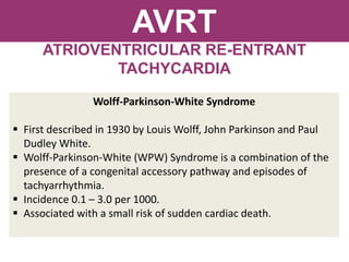 AVRT
ATRIOVENTRICULAR RE-ENTRANT
TACHYCARDIA
Wolff-Parkinson-White Syndrome
 First described in 1930 by Louis Wolff, John Parkinson and Paul
Dudley White.
 Wolff-Parkinson-White (WPW) Syndrome is a combination of the
presence of a congenital accessory pathway and episodes of
tachyarrhythmia.
 Incidence 0.1 – 3.0 per 1000.
 Associated with a small risk of sudden cardiac death.
 