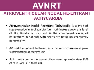 AVNRT
ATRIOVENTRICULAR NODAL RE-ENTRANT
TACHYCARDIA
 Atrioventricular Nodal Reentrant Tachycardia is a type of
supraventricular tachycardia (i.e it originates above the level
of the Bundle of His) and is the commonest cause of
palpitations in patients with hearts exhibiting no structurally
abnormality.
 AV nodal reentrant tachycardia is the most common regular
supraventricular tachycardia.
 It is more common in women than men (approximately 75%
of cases occur in females).
 