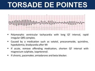TORSADE DE POINTES
 Polymorphic ventricular tachycardia with long QT interval, rapid
irregular QRS complex.
 Caused by a medication such as sotalol, procanamaide, quinidine,
hypokalemia, bradycardia after MI
 If acute, remove offending medication, shorten QT interval with
magnesium sulphate, isoprterenol.
 If chronic, pacemaker, amiodarone and beta blocker.
 