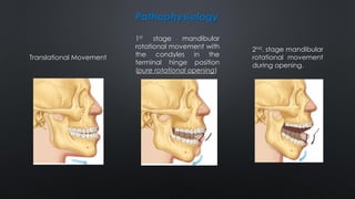 Pathophysiology
Translational Movement
1st stage mandibular
rotational movement with
the condyles in the
terminal hinge position
(pure rotational opening)
2nd. stage mandibular
rotational movement
during opening.
 