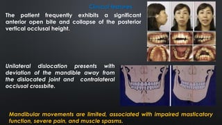 Clinical features
The patient frequently exhibits a significant
anterior open bite and collapse of the posterior
vertical occlusal height.
Unilateral dislocation presents with
deviation of the mandible away from
the dislocated joint and contralateral
occlusal crossbite.
Mandibular movements are limited, associated with impaired masticatory
function, severe pain, and muscle spasms.
 