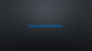 Types of dislocations
 