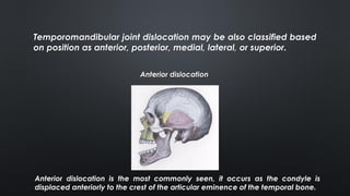 Temporomandibular joint dislocation may be also classified based
on position as anterior, posterior, medial, lateral, or superior.
Anterior dislocation
Anterior dislocation is the most commonly seen, it occurs as the condyle is
displaced anteriorly to the crest of the articular eminence of the temporal bone.
 