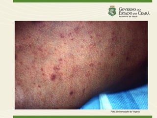 Foto: Universidade do Virginia
 