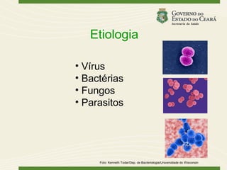 Etiologia

• Vírus
• Bactérias
• Fungos
• Parasitos




     Foto: Kenneth Todar/Dep. de Bacteriologia/Universidade do Wisconsin
 