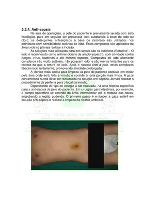 5.2.4. Anti-sepsia
        Na sala de operações, a pele do paciente é previamente lavada com soro
fisiológico, para em seguida ser preparada com substância à base de iodo ou
cloro; os detergentes anti-sépticos à base de clorofeno são utilizados nos
indivíduos com sensibilidade cutânea ao iodo. Estes compostos são aplicados na
área onde se planeja realizar a incisão.
        As soluções mais utilizadas para anti-sepsia são os iodóforos (Betadine*). O
iodo é reconhecido como antimicrobiano de amplo espectro, com atividade contra
fungos, vírus, bactérias e até mesmo esporos. Compostos de iodo altamente
complexos são muito estáveis, não possuem odor e são menos irritantes para os
tecidos do que a tintura de iodo. Após o contato com a pele, estes complexos
liberam iodo lentamente, promovendo atividade prolongada.
        A técnica mais aceita para limpeza da pele do paciente consiste em iniciar
pela área onde será feita a incisão e considerar esta porção mais limpa. A gaze
contaminada nunca deve ser recolocada na solução anti-séptica. Jamais realizar o
procedimento da periferia para o local da incisão.
        Dependendo do tipo de cirurgia a ser realizada, há uma técnica específica
para a anti-sepsia da pele do paciente. Em cirurgias gastrintestinais, por exemplo,
o campo operatório se estende da linha intermamilar até a metade das coxas,
englobando a região pudenda. O primeiro passo é embeber a gaze estéril em
solução anti-séptica e realizar a limpeza da cicatriz umbilical.
 