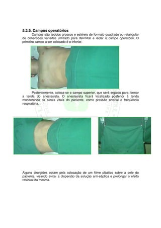 5.2.5. Campos operatórios
       Campos são tecidos grossos e estéreis de formato quadrado ou retangular
de dimensões variadas utilizado para delimitar e isolar o campo operatório. O
primeiro campo a ser colocado é o inferior.




       Posteriormente, coloca-se o campo superior, que será erguido para formar
a tenda do anestesista. O anestesista ficará localizado posterior à tenda
monitorando os sinais vitais do paciente, como pressão arterial e freqüência
respiratória.




Alguns cirurgiões optam pela colocação de um filme plástico sobre a pele do
paciente, visando evitar a dispersão da solução anti-séptica e prolongar o efeito
residual da mesma.
 