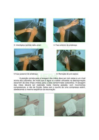 3- Interdígitos (sentido rádio-ulnar)      4- Face anterior do antebraço




5-Face posterior do antebraço                 6- Remoção do anti-séptico

      A posição correta para a lavagem das mãos deve ser com estas a um nível
acima dos cotovelos, de modo que a água e o sabão utilizados na desinquinação
escorram da área limpa (mãos) para a área contaminada (cotovelos). A secagem
das mãos deverá ser realizada nesta mesma posição, com movimentos
compressivos, e não de fricção, feitos com o auxílio de uma compressa estéril,
obedecendo a mesma seqüência da escovação.
 