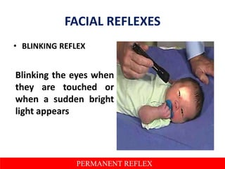 Reflex Scare ASSESSMENT OF NEWBORN REFLEXES | PPTX