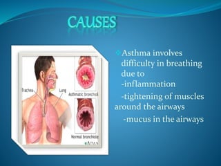 Asthma involves 
difficulty in breathing 
due to 
-inflammation 
-tightening of muscles 
around the airways 
-mucus in the airways 
 