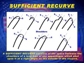 SUFFICIENT RECURVE A SUFFICIENT RECURVE consists of the space between the  shoulders of a loop free of any appendages which abut upon it at a right angle on the outside of the recurve. 1. 2. 3. 4. 5. 6. 8. 7. S S S S S S S S S S S S S S S S Shoulders 