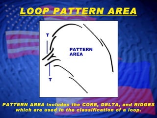 LOOP PATTERN AREA PATTERN AREA includes the CORE, DELTA, and RIDGES which are used in the classification of a loop. T T PATTERN AREA 
