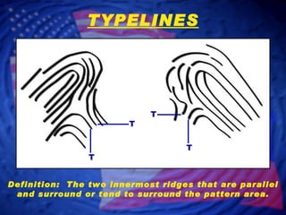 Definition:  The two innermost ridges that are parallel and surround or tend to surround the pattern area. T T T T TYPELINES 