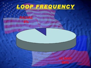 LOOP FREQUENCY 