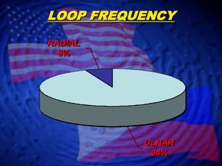 LOOP FREQUENCY