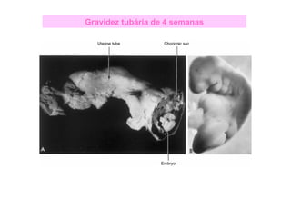 3ª Semana do Desenvolvimento Embrionário
GastrulaçãoGastrulação:
 Disco embrionário trilaminar
Formação dos folhetos ge...