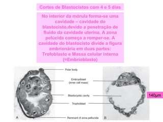 Cortes de Blastocistos com 4 e 5 dias
No interior da mórula forma-se uma
cavidade – cavidade do
blastocisto,devido a penetração de
fluído da cavidade uterina. A zona
pelúcida começa a romper-se. A
cavidade do blastocisto divide a figura
embrionária em duas partes:
Trofoblasto e Massa celular interna
(=Embrioblasto)
140µm
 